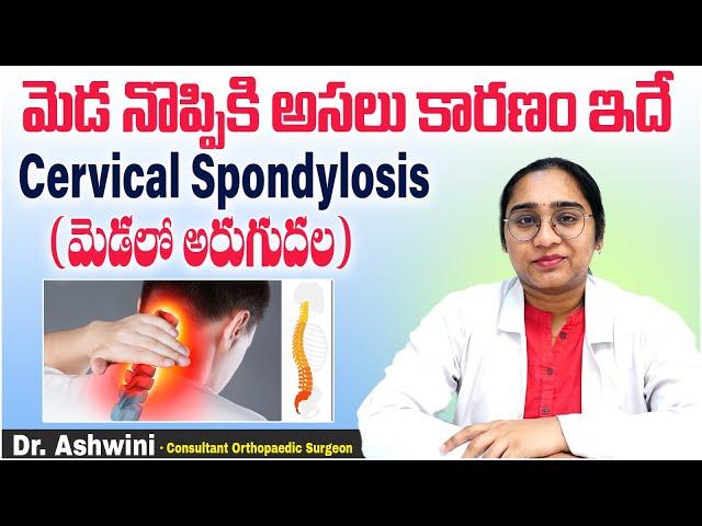 Cervical Spondylosis Symptoms in Telugu || Neck Pain Causes & Treatment || Sankhya Hospitals