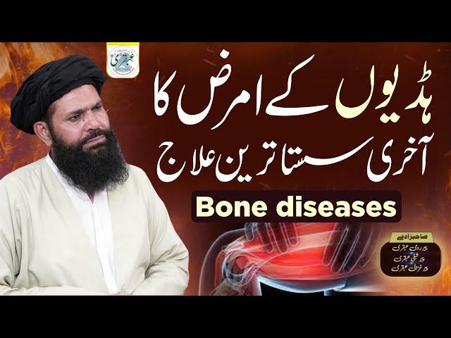 Hadiyon ke Amraaz ka Ilaaj | Affordable & Easy Treatments for Bone Diseases | Hakeem Tariq Mehmood