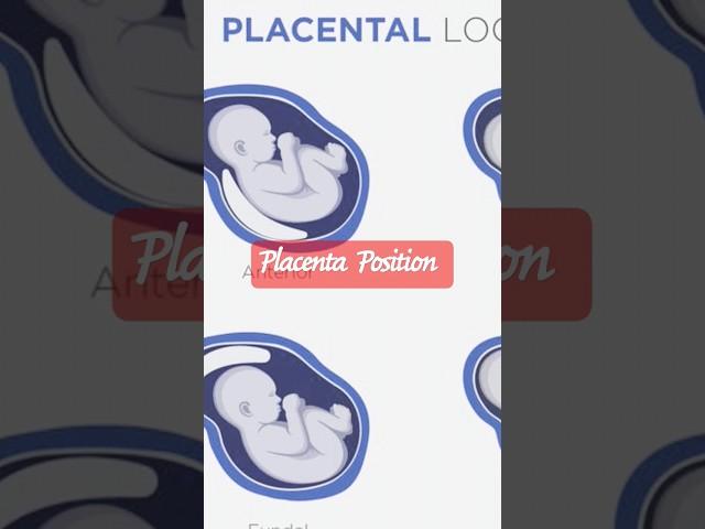 Placenta Position | Ultrasound #baby #pregancyultrasound #genderreveal #ultrasound