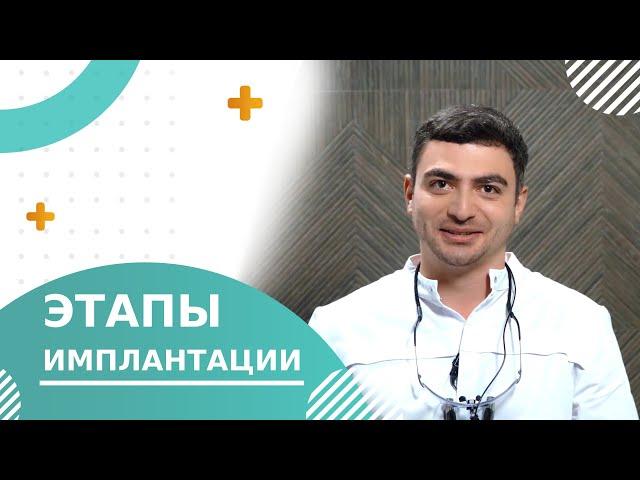  Этапы имплантации зубов: диагностика, сроки и особенности. Этапы имплантации зубов видео. 18+