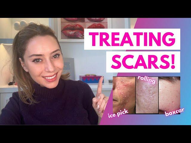 How To Treat Scars: Flat, Depressed, Raised, and Keloids | Dr. Shereene Idriss