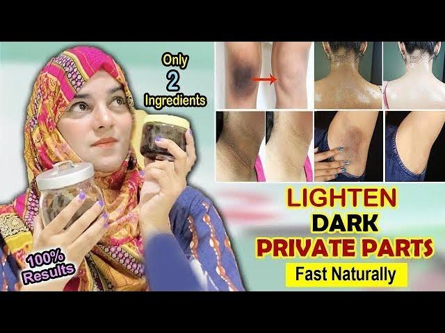 Lighten your DARK Body parts & Private Area Whitening | Dark Intimate Areas Treatment | 100% Result