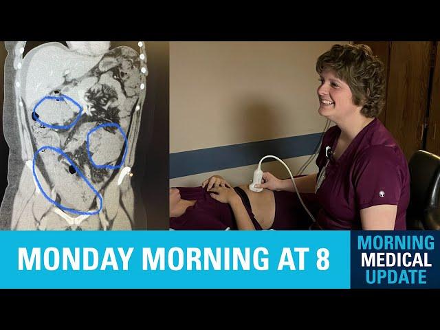 Morning Medical Update - Ovarian Cancer