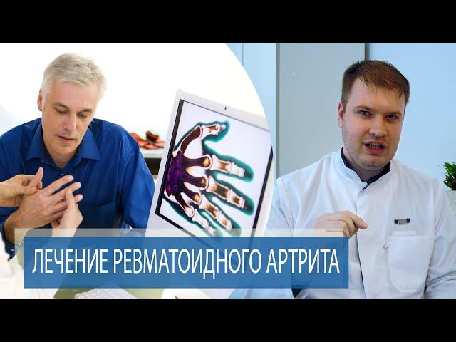 ЛЕЧЕНИЕ РЕВМАТОИДНОГО АРТРИТА | Способы лечения