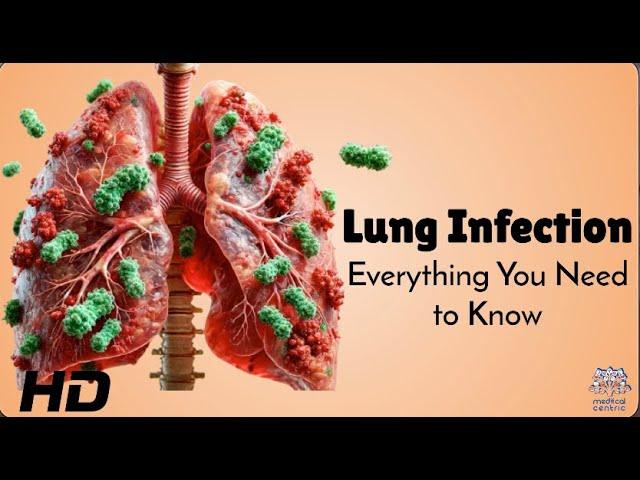 Lung Infection or Just a Cold? How to Tell the Difference