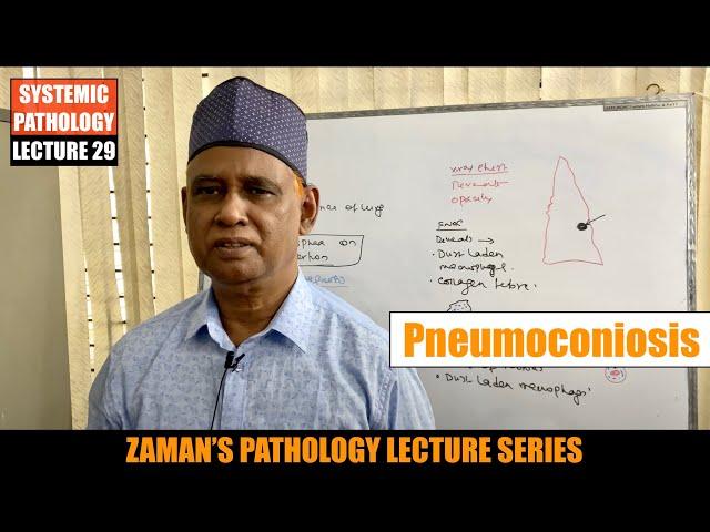 Systemic Pathology: Lecture 29 | Diseases of Respiratory  System : Day 07 - Pneumoconiosis