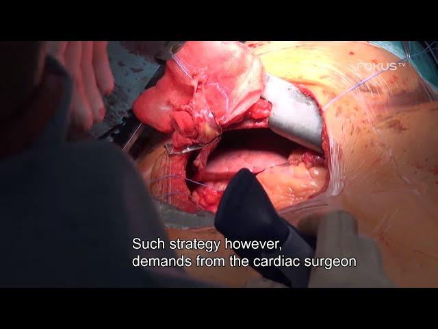 The operating room, Season 1 Episode 3 - Bypasses [ENG]