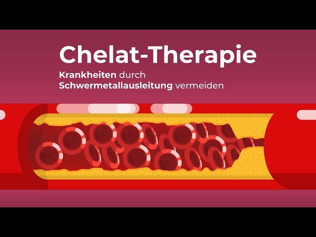 Wie funktioniert die Chelat-Therapie? Arteriosklerose durch Schwermetallausleitung vermeiden