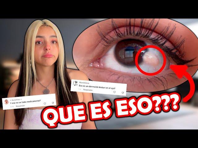 Que tengo en el ojo?? - yaneireach
