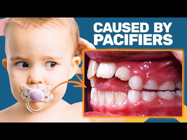 The Dangers of Pacifier Use (And How to Avoid Them)