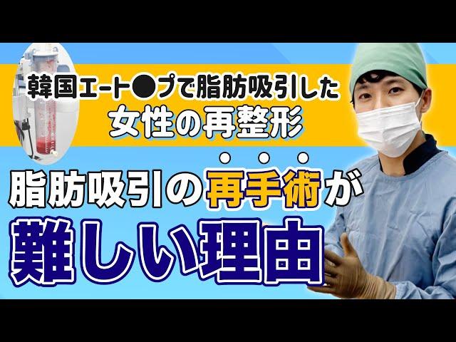 【再整形】韓国で脂肪吸引した女性！脂肪の取り残しを解決するため名倉のもとへ。脂肪吸引再手術が難しい理由を解説