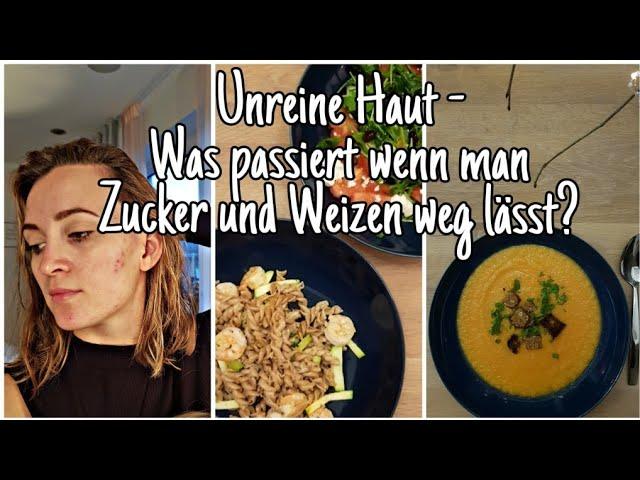 Ernährungsumstellung inkl. Rezepte | Hautprobleme| Spätakne| Die Siwuchins