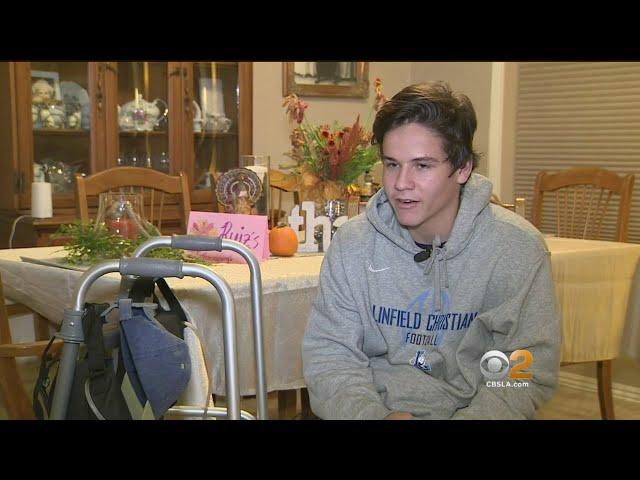 Injured High School Quarterback Opts For Life With Prosthetic Leg