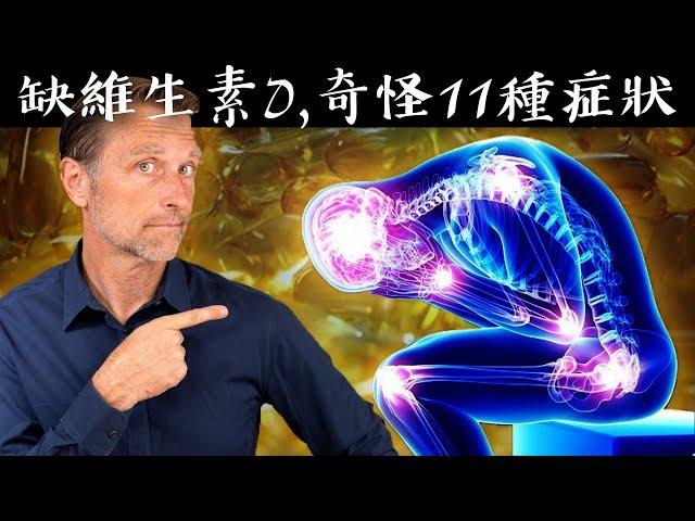 缺維生素D出現11種怪症狀,這些你有嗎？自然療法,柏格醫生 Dr Berg