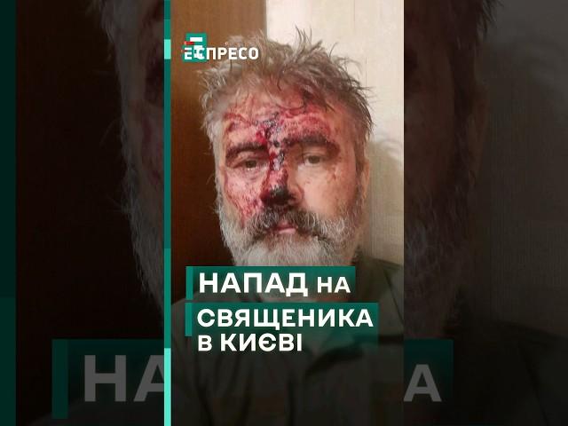  Цинічний напад на Митрополита Кримського Климента, який служить в ЗСУ! #еспресо #новини #блог