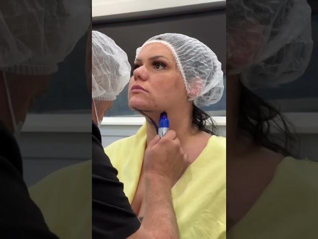 Angelina Castro Chin FlexSculpt procedure with Dr. V