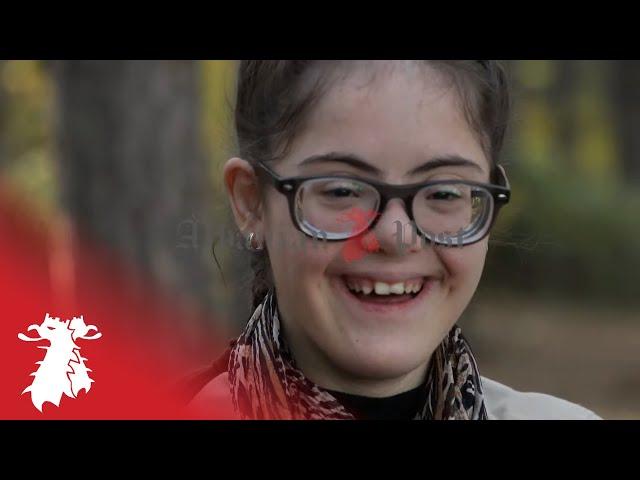 Sumeja, vajza me kromozomin e dashurise - Albanian Post