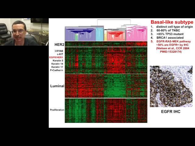 Charles Perou - Keynote Breast Cancer Genomics and Genetics