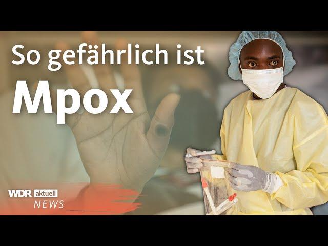 Mpox: WHO ruft weltweite Notlage aus | WDR Aktuelle Stunde