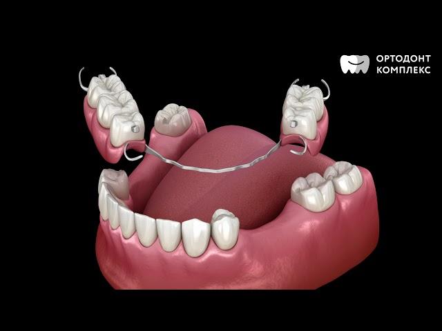 Съемный зубной протез