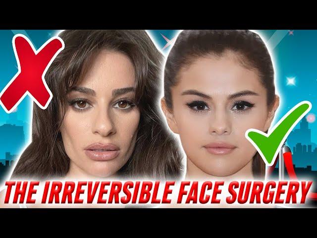 The Truth Behind Buccal Fat Removal FAILS vs. Successes: Using Celebrity Examples