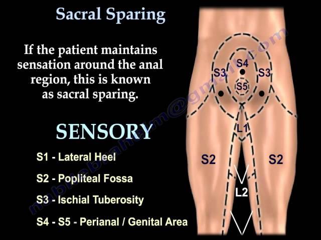 Sacral Sparing - Everything You Need To Know - Dr. Nabil Ebraheim