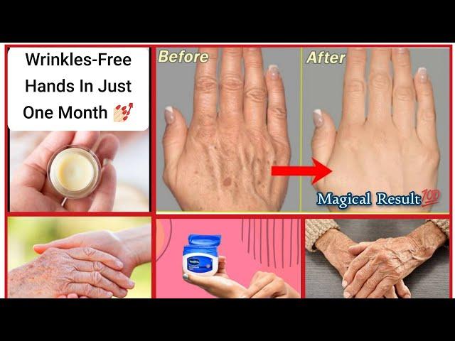 Wrinkles-Free Soft & Smooth Hands In Just One Month || How to make your hands look 5 years younger