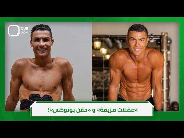 هل لجأ «الدون» لـ عمليات التجميل؟!