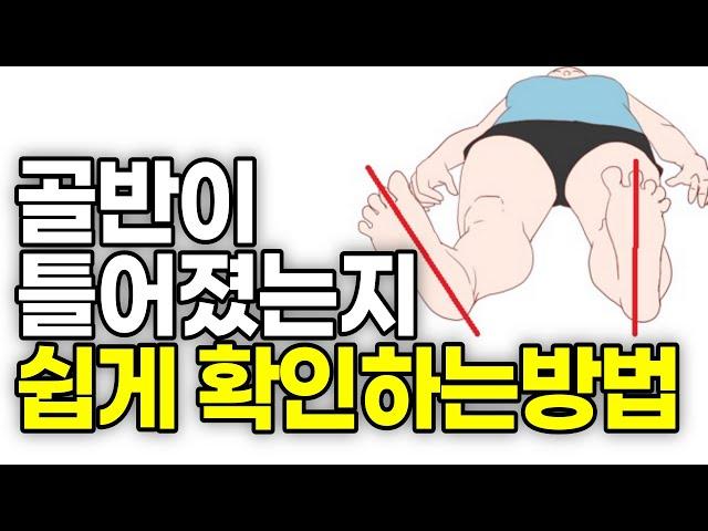 골반교정, 골반 자가진단 방법, 허리 통증이 있다면 꼭 확인해보세요!! 혼자 하는 골반교정 운동