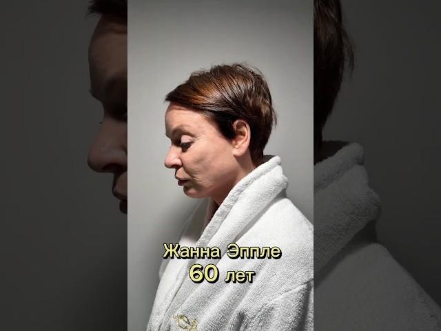 Жанна Эппле до/после невидимой подтяжки лица!  #сергейсвиридов