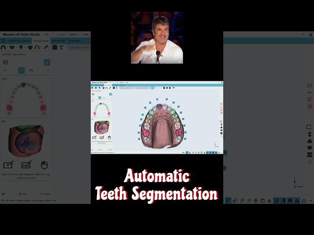 Maestro 3D | Dental Studio