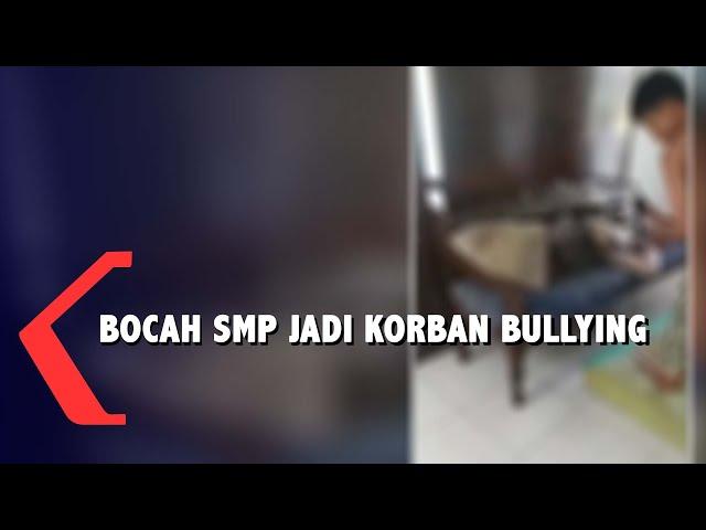 Bocah SMP di Malang Jadi Korban Perundungan Teman Bermainnya