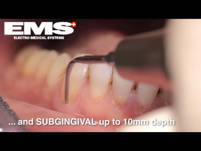 Piezon Instrument PS, sub- and supragingival scaling & root debridement