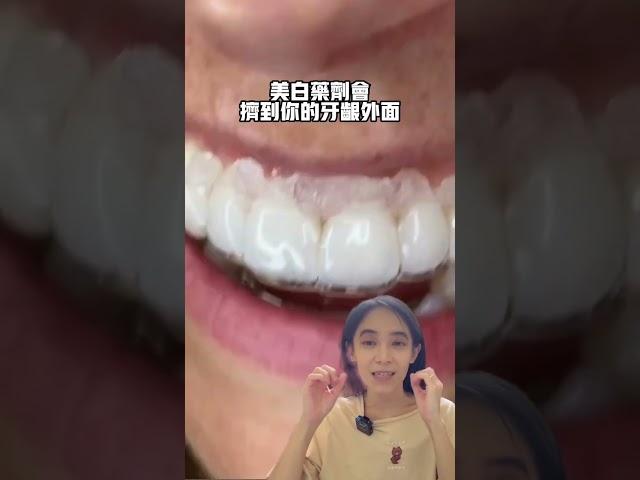 牙套維持器可以當美白牙托使用嗎#牙齒矯正#牙齒美白