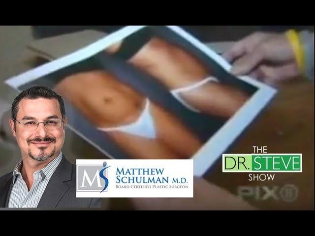 Smooth Tuck on Dr. Steve - Schulman Plastic Surgery