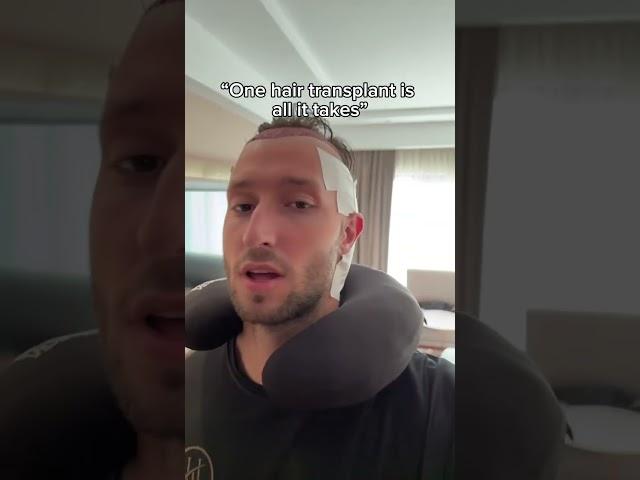 CRAZY HAIR TRANSPLANT RESULTS