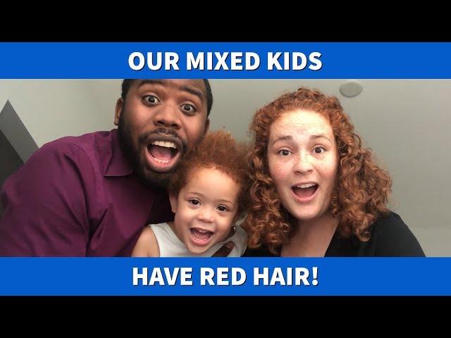 Why Do Our Mixed Kids Have Red Hair?