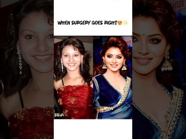 When Surgery Goes Right for Bollywood Actresses  #BollywoodBeauty #GlowUp #Transformation