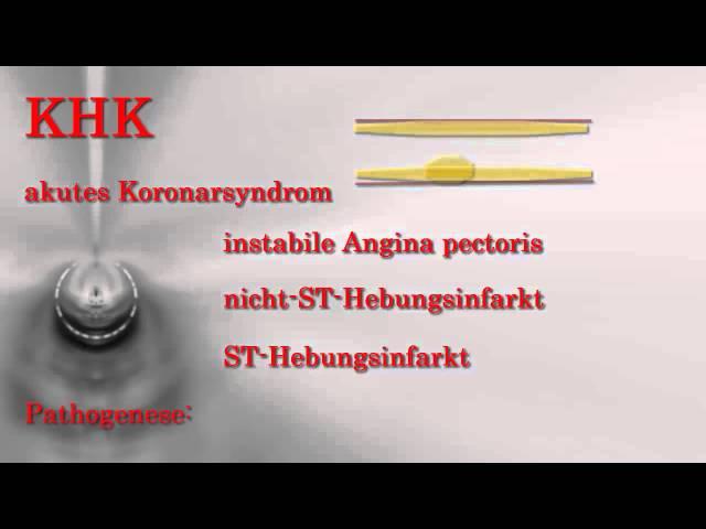 Innere Medizin ─ Koronare Herzkrankheiten KHK