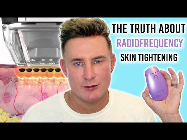 The Truth About Radiofrequency Skin Tightening | Facelift Without Surgery