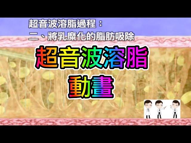 超音波溶脂動畫