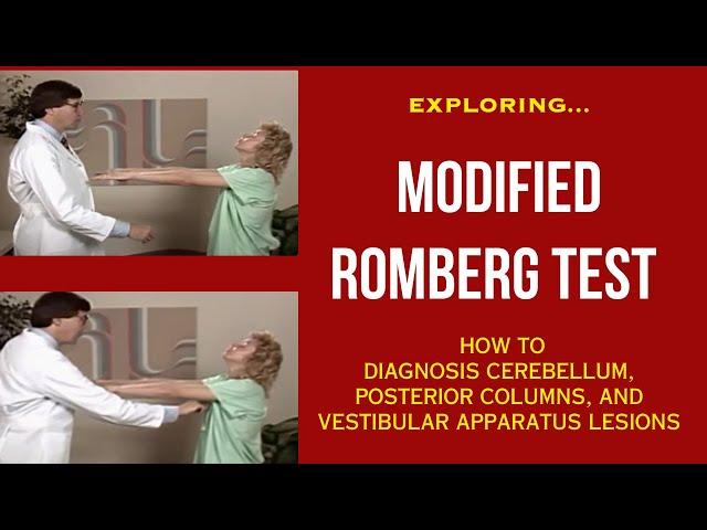 Exploring Romberg Test: Diagnosis Cerebellum, Posterior Columns, and Vestibular Apparatus lesions!