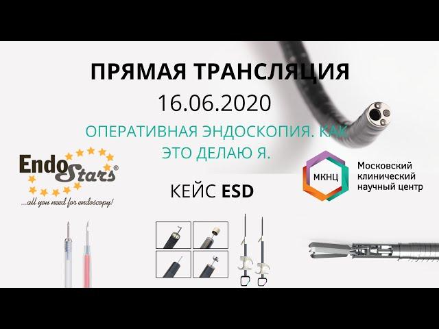 ESD,  "Оперативная эндоскопия. Как это делаю Я".