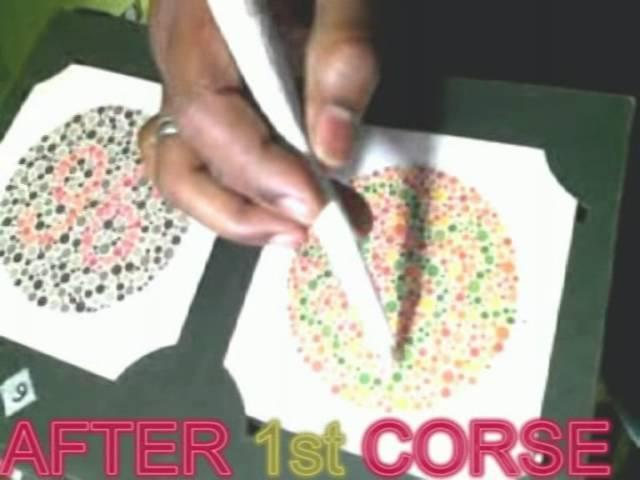 COLOR BLINDNESS CURE Dr RISHABH JAIN  +91-9425092329