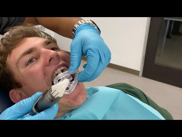 I2 and isodry Isolite Anterior Mouthpiece Adapter – Placement tips and techniques