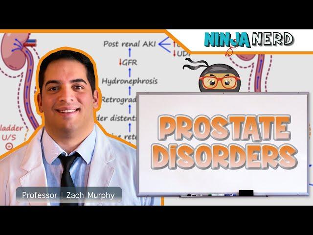 Prostate Disorders | Clinical Medicine