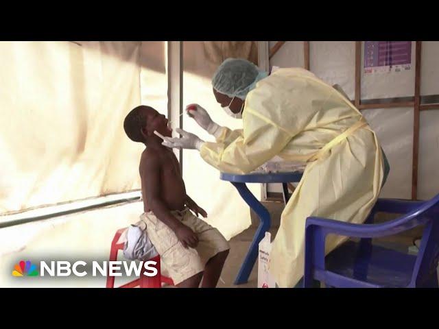 WHO declares global emergency as mpox virus spreads across Africa