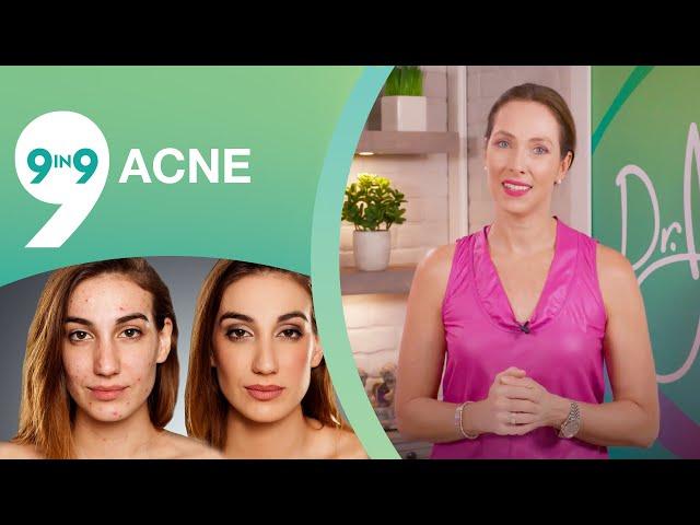 9 Hidden Secrets for Acne  : How to Get Rid Of Acne : Dr J9 - live