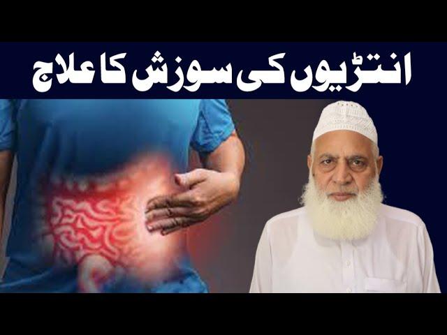 Anton Ki Sozish Ka | Anton Ki Khushki | Aanto Ki Sujan | Intestine Infection Ka ilaj Dr M Arshad