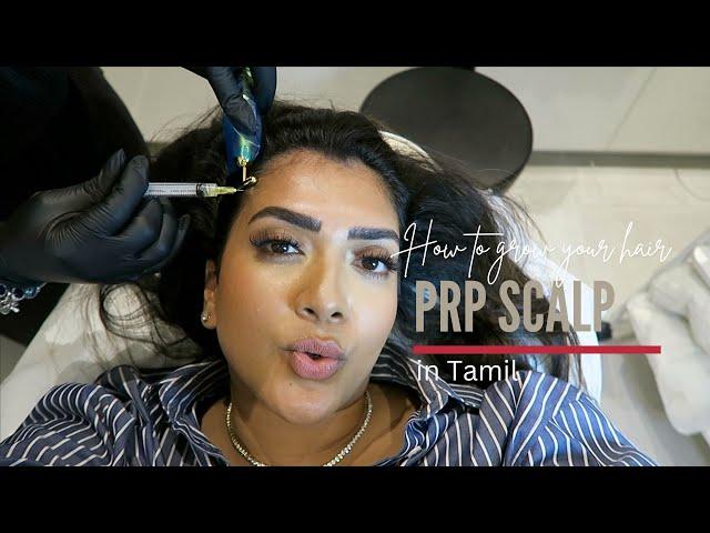 PRP Scalp | in Tamil | Vithya Hair and Makeup